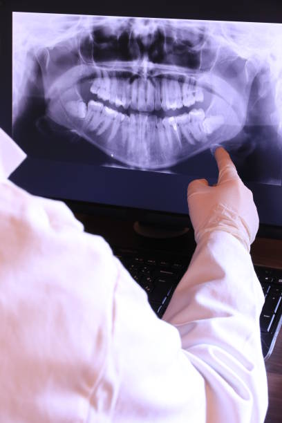 Best Emergency Tooth Extraction in Tishomingo, OK